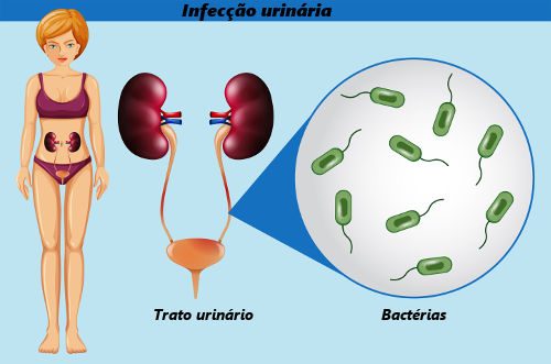 Infecção Urinária 
