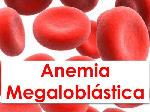Anemias Megaloblásticas 