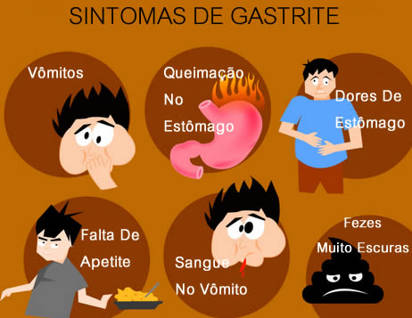 Sintomas Da Gastrite 