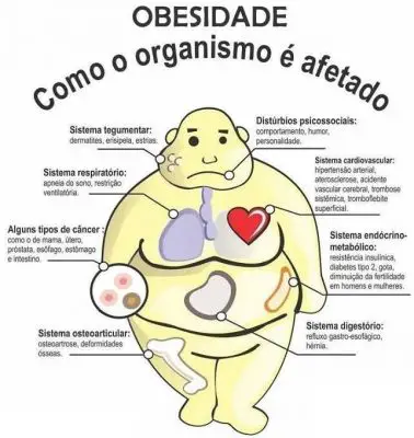 Sintomas da Obesidade