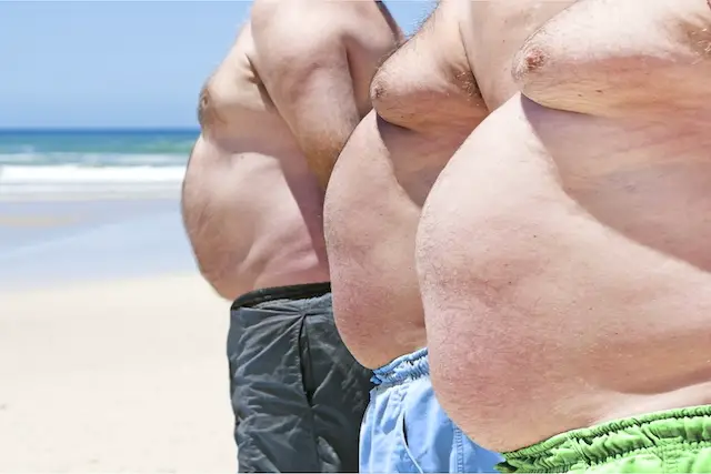 Tipos de Obesidade
