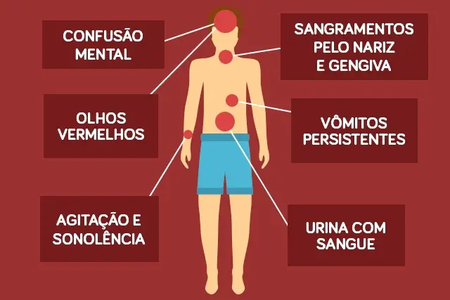 Sintomas da Dengue Hemorrágica 