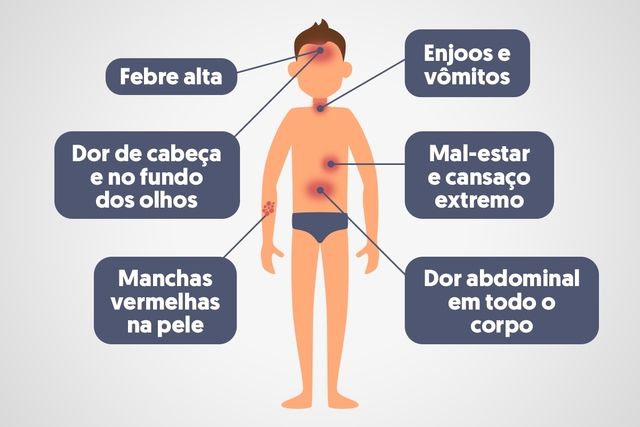 Sintomas da Dengue 
